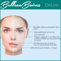Curso Online de Terapias Avanzadas para la Parálisis Facial: Recupera la Armonía de tu Rostro